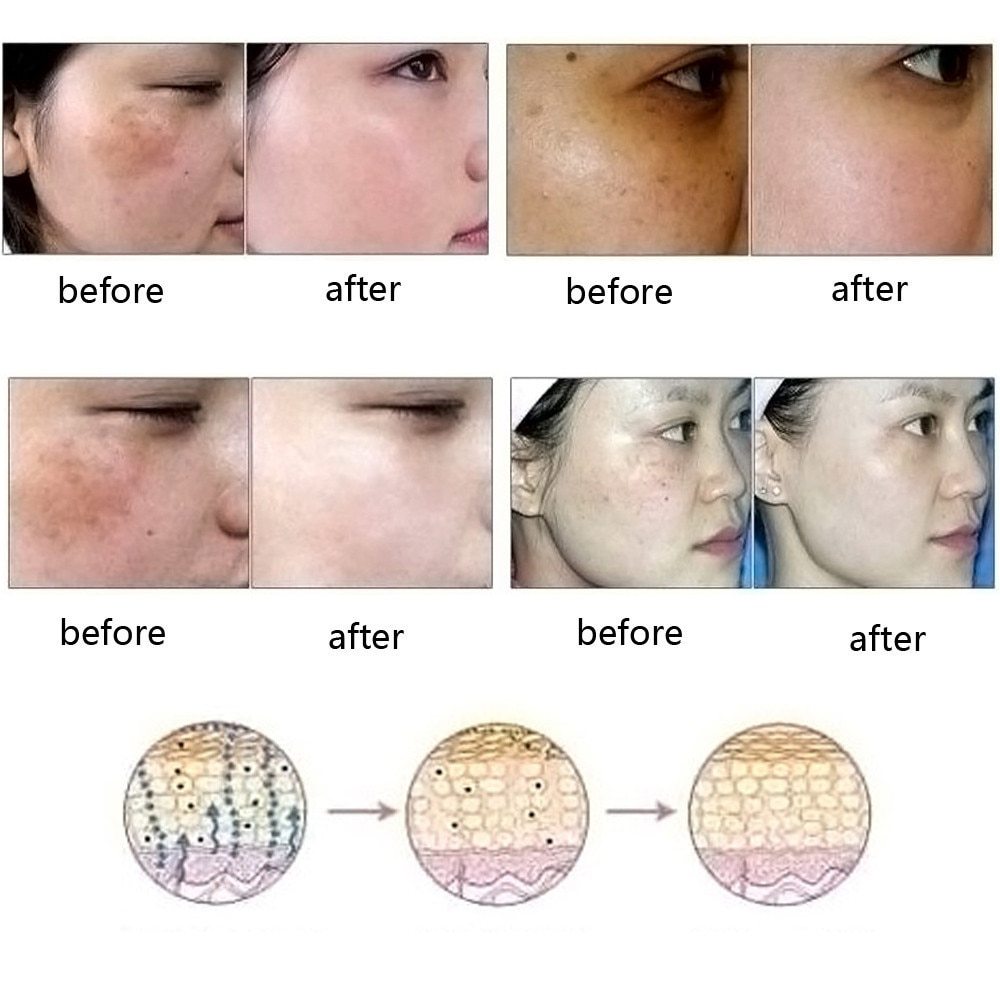 Orient Fragrance Science Dredge Meridian Skin Care Natural Pure Removal Acne Stretch Marks Scar Removal Essence oil