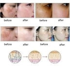 Orient Fragrance Science Dredge Meridian Skin Care Natural Pure Removal Acne Stretch Marks Scar Removal Essence oil