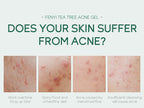 20g Moisturizing Skin Care Products