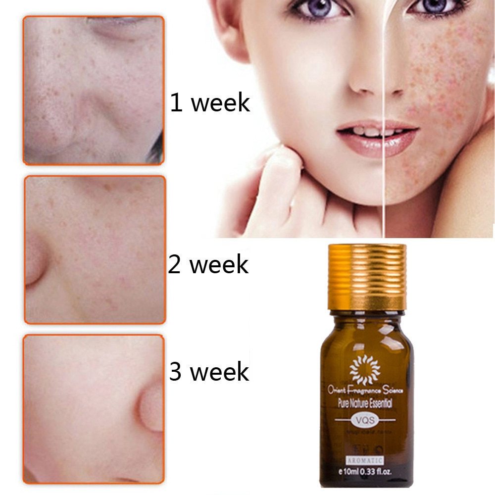 Orient Fragrance Science Dredge Meridian Skin Care Natural Pure Removal Acne Stretch Marks Scar Removal Essence oil
